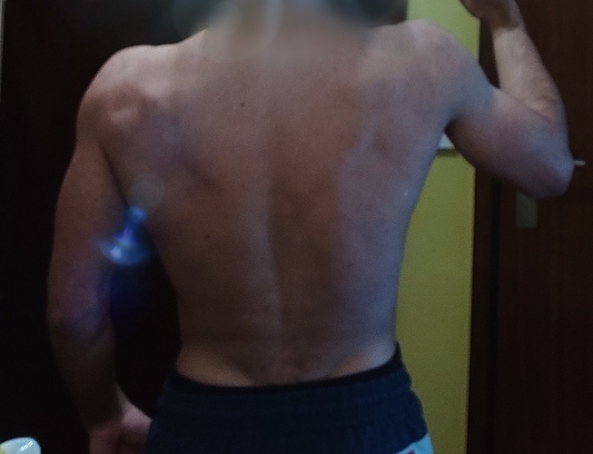 Back