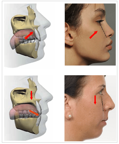 maxillary